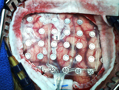 Illustration for article titled Here's how Obama's brain mapping project will actually work